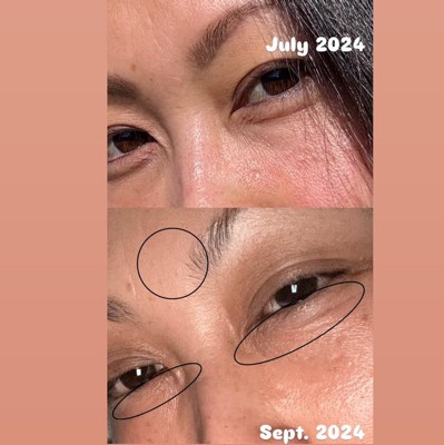 Roc Retinol Correxion Line Smoothing Anti aging Wrinkle Eye Cream For Dark Circles Puffy Eyes 0.5 Fl Oz Target