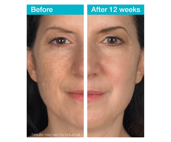 Buy MD Complete Dark Spot Corrector 1 oz Online at desertcartKUWAIT