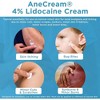 Patrin Lidocaine 4% Topical Anesthetic Cream  Fast Numbing Relief in Convenient 5 g Tubes, Pack of 5 - 4 of 4