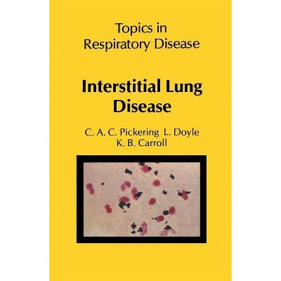 Interstitial Lung Disease - by  C a C Pickering & L Doyle & K B Carroll (Paperback)