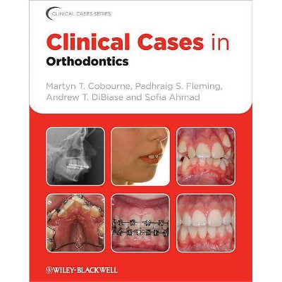 Clinical Cases in Orthodontics - (Clinical Cases (Dentistry)) by  Andrew T Dibiase & Sofia Ahmad & Martyn T Cobourne (Paperback)