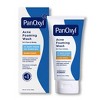 PanOyxl 2 Pack/5.5oz Maximum Strength Antimicrobial Acne Foaming Wash for Face, Chest and Back with 10% Benzoyl Peroxide - Unscented - 2 of 4