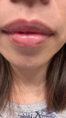 Guest review image 2 of 2, zoom in