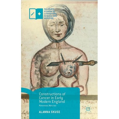 Constructions of Cancer in Early Modern England - (Palgrave Studies in Literature, Science and Medicine) by  Alanna Skuse (Paperback)