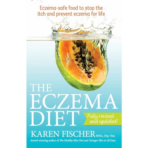 Eczema Diet - 2nd Edition by  Karen Fischer (Paperback) - image 1 of 1