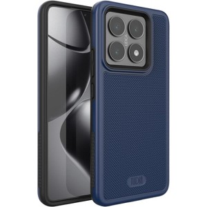 TUDIA Xiaomi 14T 5G (2024) MergeGrip Series Case - 1 of 4