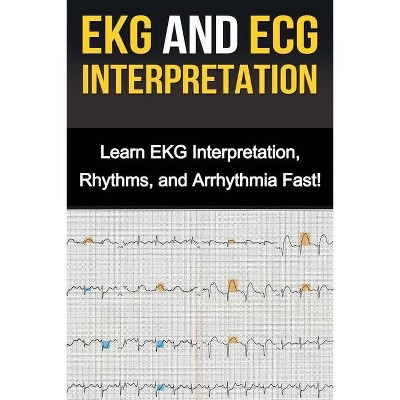 EKG and ECG Interpretation - by  Alyssa Stone (Paperback)