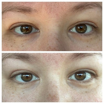 Guest review image 1 of 2, zoom in