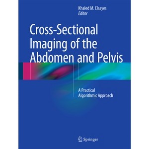 Cross-Sectional Imaging of the Abdomen and Pelvis - by  Khaled M Elsayes (Hardcover) - 1 of 1