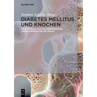 Diabetes Mellitus Und Knochen - by  Stephan Scharla (Hardcover)