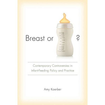 Breast or Bottle? - (Studies in Rhetoric & Communication) by  Amy Koerber (Paperback)