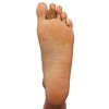 ZenToes Single Loop Toe Spacer for Bunion Pain Relief - 2pk - 4 of 4