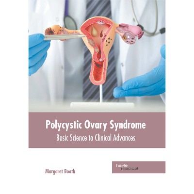 Polycystic Ovary Syndrome: Basic Science to Clinical Advances - by  Margaret Booth (Hardcover)
