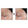 RoC Deep Wrinkle Retinol Patches - 6ct - 4 of 4