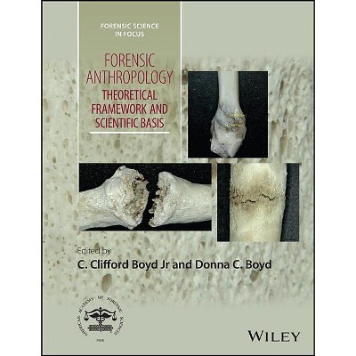 Forensic Anthropology - (Forensic Science in Focus) by  C Clifford Boyd & Donna C Boyd (Hardcover)