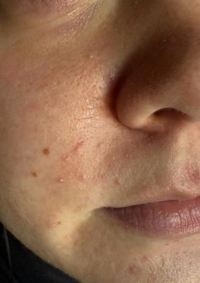 Guest review image 1 of 3, zoom in