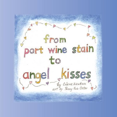 From Port Wine Stain to Angel Kisses - by  Colene Newton (Paperback)